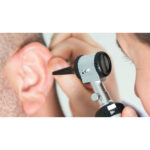 چگونه از عفونت قارچی گوش جلوگیری کنیم؟