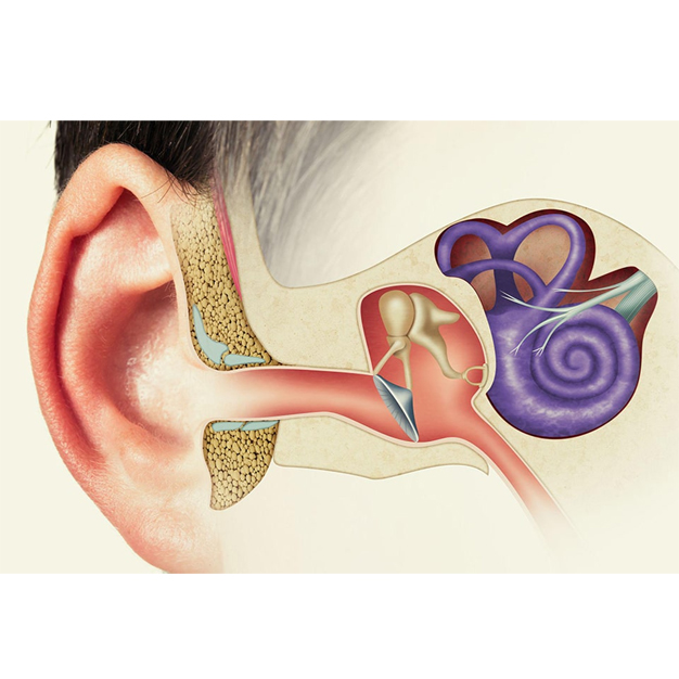 آیا-بیماری-سندرم-مینیر-قابل-پیشگیری-است؟