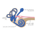 روش‌های نوین درمان بیماری سندرم مینیر