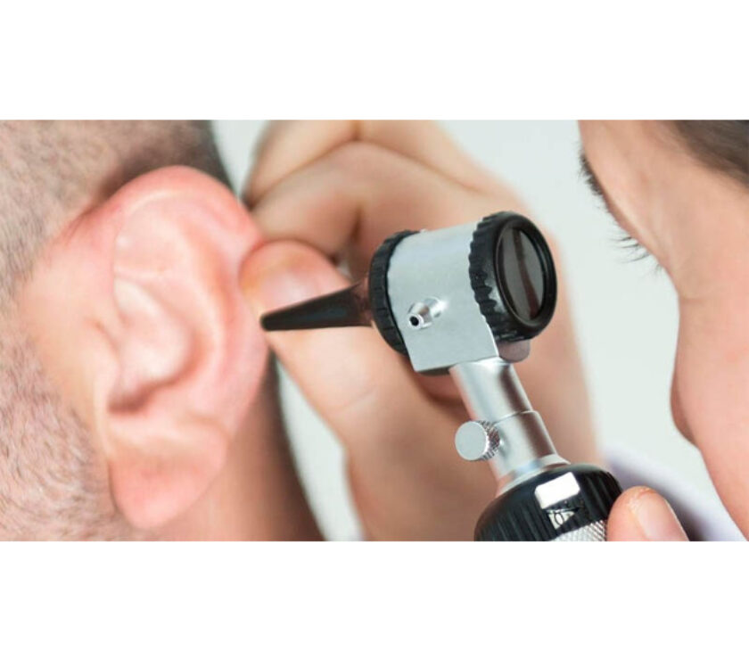 چگونه از عفونت قارچی گوش جلوگیری کنیم؟ عفونتهای قارچی گوش یکی از مشکلات شایع بهداشتی هستند که میتوانند باعث ناراحتی و مشکلات جدیتری شوند. این نوع عفونتها معمولاً به دلیل رشد بیش از حد قارچها در گوش ایجاد میشوند و میتوانند به علائمی مانند خارش، درد و ترشح منجر شوند. در این مقاله، به بررسی روشهای جلوگیری از عفونت قارچی گوش میپردازیم و نکات مهمی را برای حفظ سلامت گوشها ارائه میدهیم. ۱. شناخت عوامل خطر برای جلوگیری از عفونت قارچی گوش، اولین قدم شناخت عوامل خطر است. برخی از این عوامل شامل: رطوبت بالا: قرار گرفتن در محیطهای مرطوب میتواند به رشد قارچها کمک کند. استفاده از سمعک یا هدفون: این وسایل میتوانند رطوبت و گرما را در گوش نگه دارند. عفونتهای قبلی: افرادی که سابقه عفونتهای گوش دارند، بیشتر در معرض خطر هستند. سیستم ایمنی ضعیف: افرادی که دارای بیماریهای مزمن یا نقص ایمنی هستند، بیشتر در معرض عفونتهای قارچی قرار دارند. ۲. حفظ بهداشت گوش یکی از مهمترین راههای جلوگیری از عفونت قارچی گوش، حفظ بهداشت گوش است. برای این کار میتوانید از نکات زیر پیروی کنید: تمیز نگهداشتن گوش: از استفاده از گوشپاککنها برای تمیز کردن گوش خودداری کنید. این کار میتواند باعث آسیب به پرده گوش و ایجاد شرایط مناسب برای رشد قارچها شود. خشک کردن گوش: پس از شنا یا دوش گرفتن، گوشهای خود را به آرامی خشک کنید. میتوانید از حوله نرم استفاده کنید یا سر خود را به یک طرف خم کنید تا آب خارج شود. استفاده از قطرههای گوش: در صورت نیاز، میتوانید از قطرههای گوش مخصوص برای خشک کردن رطوبت اضافی استفاده کنید. ۳. اجتناب از محیطهای مرطوب محیطهای مرطوب میتوانند به رشد قارچها کمک کنند. برای جلوگیری از عفونت قارچی گوش، از قرار گرفتن در این محیطها خودداری کنید: استخرها و سونا: اگر به استخر یا سونا میروید، حتماً از گوشگیر استفاده کنید. آب و هوای مرطوب: در روزهای مرطوب، از فعالیتهایی که ممکن است باعث خیس شدن گوشها شوند، خودداری کنید. ۴. تقویت سیستم ایمنی سیستم ایمنی قوی میتواند به جلوگیری از عفونتهای قارچی کمک کند. برای تقویت سیستم ایمنی خود، میتوانید: تغذیه مناسب: مصرف میوهها و سبزیجات تازه، پروتئینهای سالم و غلات کامل میتواند به تقویت سیستم ایمنی کمک کند. ورزش منظم: فعالیت بدنی منظم میتواند به بهبود عملکرد سیستم ایمنی کمک کند. خواب کافی: خواب کافی و با کیفیت میتواند به بهبود سیستم ایمنی کمک کند. ۵. مشاوره با پزشک اگر شما یا یکی از اعضای خانوادهتان دچار عفونتهای مکرر گوش هستید، بهتر است با پزشک مشورت کنید. پزشک میتواند علت اصلی عفونتها را شناسایی کرده و درمانهای مناسب را تجویز کند. ۶. استفاده از داروهای ضدقارچی در برخی موارد، پزشک ممکن است داروهای ضدقارچی را برای جلوگیری از عفونتهای قارچی گوش تجویز کند. این داروها میتوانند به کاهش خطر عفونت کمک کنند و معمولاً به صورت قطره یا قرص مصرف میشوند. ۷. رعایت نکات بهداشتی در هنگام سفر سفر به مکانهای جدید میتواند شما را در معرض عوامل خطر جدید قرار دهد. برای جلوگیری از عفونت قارچی گوش در سفر، نکات زیر را رعایت کنید: استفاده از وسایل شخصی: از وسایل شخصی خود مانند حوله و گوشپاککن استفاده کنید و از به اشتراک گذاشتن آنها با دیگران خودداری کنید. مراقبت از گوشها در هنگام پرواز: در طول پرواز، از جویدن آدامس یا بلعیدن آب برای کاهش فشار در گوشها استفاده کنید. ۸. شناخت علائم عفونت قارچی گوش آگاهی از علائم عفونت قارچی گوش میتواند به شما کمک کند تا در صورت بروز مشکل، سریعتر اقدام کنید. برخی از علائم شامل: خارش و سوزش در گوش درد گوش ترشح مایع از گوش کاهش شنوایی اگر هر یک از این علائم را تجربه کردید، بهتر است به پزشک مراجعه کنید. ۹. نتیجهگیری عفونتهای قارچی گوش میتوانند باعث ناراحتی و مشکلات جدی شوند، اما با رعایت نکات بهداشتی و پیشگیرانه میتوان از بروز آنها جلوگیری کرد. حفظ بهداشت گوش، اجتناب از محیطهای مرطوب، تقویت سیستم ایمنی و مشاوره با پزشک از جمله راههای مؤثر در جلوگیری از عفونتهای قارچی گوش هستند. با رعایت این نکات، میتوانید سلامت گوشهای خود را حفظ کرده و از عفونتهای قارچی جلوگیری کنید. ۱۰. اهمیت استفاده از لباسهای مناسب لباسهایی که در هنگام شنا یا فعالیتهای آبی میپوشید، میتوانند تأثیر زیادی بر سلامت گوشهای شما داشته باشند. انتخاب لباسهای خشک و مناسب که رطوبت را به خود جذب نکنند، میتواند به کاهش خطر عفونتهای قارچی کمک کند. همچنین، استفاده از کلاههای مخصوص شنا میتواند از ورود آب به گوشها جلوگیری کند. ۱۱. مراقبت از گوشها در فصول بارانی در فصول بارانی، رطوبت هوا افزایش مییابد و این میتواند خطر عفونتهای قارچی را افزایش دهد. برای کاهش این خطر، سعی کنید از قرار گرفتن در معرض باران به مدت طولانی خودداری کنید و در صورت خیس شدن، گوشهای خود را به سرعت خشک کنید. همچنین، استفاده از چتر یا کلاه میتواند به محافظت از گوشها کمک کند. ۱۲. بررسی داروهای مصرفی برخی از داروها ممکن است عوارض جانبی داشته باشند که به افزایش خطر عفونتهای قارچی منجر شود. اگر شما داروهای خاصی مصرف میکنید، با پزشک خود در مورد تأثیر آنها بر سلامت گوشهایتان مشورت کنید. ممکن است نیاز باشد که داروهای جایگزین یا مکملهای غذایی برای تقویت سیستم ایمنی خود در نظر بگیرید. ۱۳. توجه به عادات روزمره عادات روزمره شما میتوانند بر سلامت گوشها تأثیر بگذارند. از جمله این عادات میتوان به استفاده مکرر از گوشیهای هوشمند و هدفون اشاره کرد. سعی کنید زمان استفاده از این وسایل را محدود کنید و در فواصل زمانی مناسب، گوشهای خود را استراحت دهید. ۱۴. مشاوره با متخصص گوش و حلق و بینی اگر با وجود رعایت نکات بهداشتی و پیشگیرانه، همچنان دچار عفونتهای مکرر گوش میشوید، بهتر است به یک متخصص گوش و حلق و بینی مراجعه کنید. این متخصصان میتوانند با بررسی دقیقتر، مشکلات زمینهای را شناسایی کرده و درمانهای مؤثری را پیشنهاد دهند. ۱۵. آگاهی از روشهای درمانی در صورتی که دچار عفونت قارچی گوش شدید، آگاهی از روشهای درمانی میتواند به شما کمک کند تا سریعتر بهبود یابید. درمانهای خانگی مانند استفاده از روغنهای طبیعی یا سرکه سیب ممکن است به کاهش علائم کمک کنند، اما همیشه بهتر است قبل از شروع هر درمانی با پزشک مشورت کنید. ۱۶. نتیجهگیری نهایی با توجه به اینکه عفونتهای قارچی گوش میتوانند عواقب جدی داشته باشند، رعایت نکات پیشگیرانه و بهداشتی از اهمیت ویژهای برخوردار است. با شناخت عوامل خطر، حفظ بهداشت گوش، و تقویت سیستم ایمنی، میتوانید به طور مؤثری از بروز این عفونتها جلوگیری کنید. همچنین، در صورت بروز علائم، سریعاً به پزشک مراجعه کنید تا از عوارض بیشتر جلوگیری شود. سلامت گوشهای شما، سلامت کلی شما را تضمین میکند.